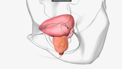 RTU de próstata: cirurgia de próstata que corrige prejuízos no fluxo de urina